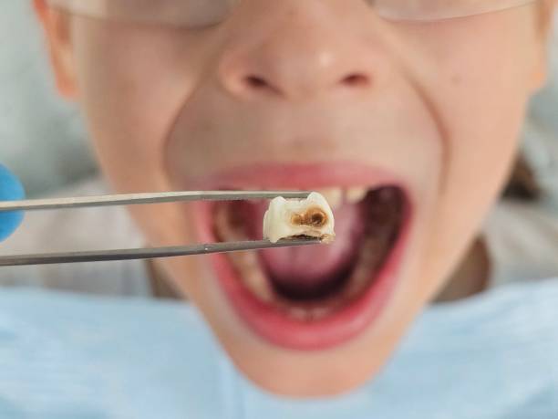 Best Pediatric Emergency Dentist in Lyford, TX
